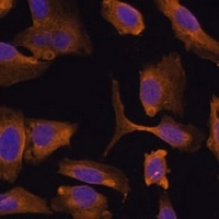 Anti-MTMR4 Antibody