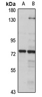 MTMR8 Antibody