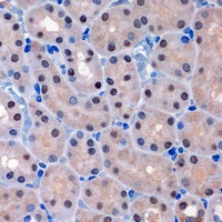 MTMR8 Antibody