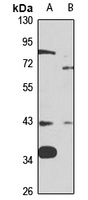 MT-ND2 Antibody