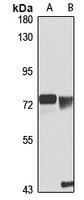 MT-ND5 Antibody