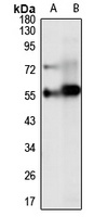 PAPD1 Rabbit Polyclonal Antibody