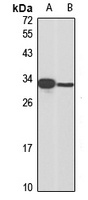 MAD2 Rabbit Polyclonal Antibody
