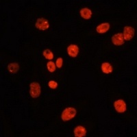 Anti-MTLC Antibody