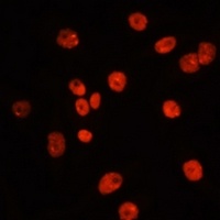 MTLC antibody