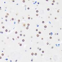 Anti-MYEF2 Antibody