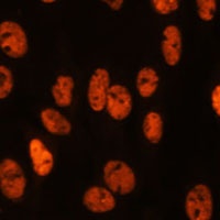 Anti-MYEF2 Antibody