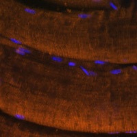 Myosin 2 Rabbit Polyclonal Antibody