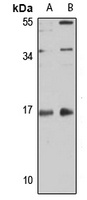 MYL12A Antibody