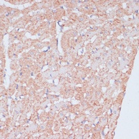 Anti-MZB1 Antibody