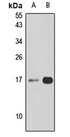 MZT2B Rabbit Polyclonal Antibody