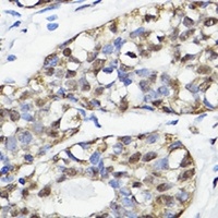 Anti-NAV2 Antibody