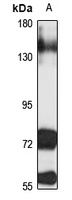 NCAM2 Rabbit Polyclonal Antibody