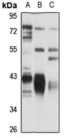 NDUFA10 Rabbit Polyclonal Antibody