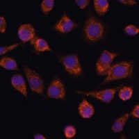 Anti-NDUFAF2 Antibody