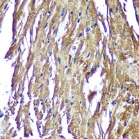 Anti-NDUFAF4 Antibody