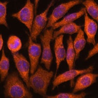 Anti-NDUFAF4 Antibody