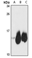 NDUFB2 Antibody