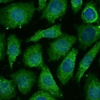 Anti-NDUFB3 Antibody