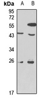 NeuroD Rabbit Polyclonal Antibody