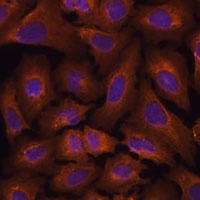 NEXN Antibody