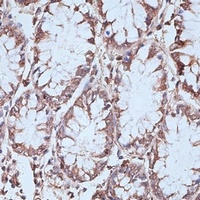 Anti-NFE2L1 Antibody