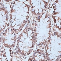 NFE2L1 antibody