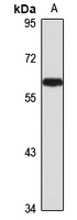 NF-1A Rabbit Polyclonal Antibody