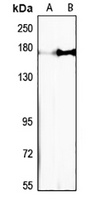 Nischarin Rabbit Polyclonal Antibody