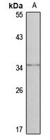 NKX3-2 Rabbit Polyclonal Antibody