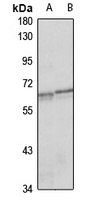 NLK Rabbit Polyclonal Antibody