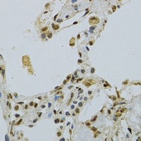Anti-NLK Antibody