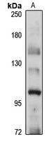 NALP11 Rabbit Polyclonal Antibody