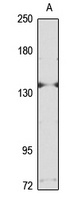 NLRP5 Antibody