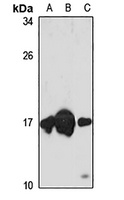 nm23-H2 Rabbit Polyclonal Antibody