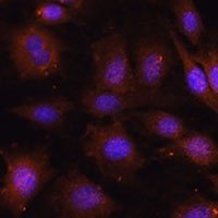 Anti-NOB1 Antibody