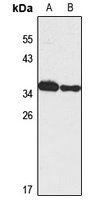 NOL12 Rabbit Polyclonal Antibody