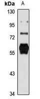Nova-1 Rabbit Polyclonal Antibody