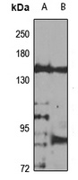 Nephrocystin-3 Antibody