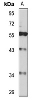 GPR154 Rabbit Polyclonal Antibody
