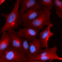 Anti-NQO2 Antibody