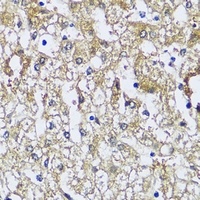 Anti-NQO2 Antibody