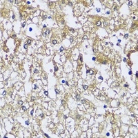 NQO2 antibody