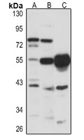 LXR beta Rabbit Polyclonal Antibody