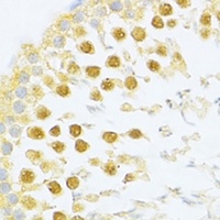 Anti-SXR Antibody