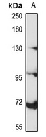 Mineralocorticoid Receptor Rabbit Polyclonal Antibody