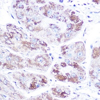 Mineralocorticoid Receptor Rabbit Polyclonal Antibody