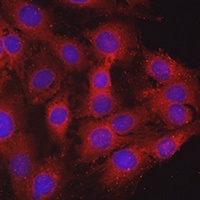 Mineralocorticoid Receptor Rabbit Polyclonal Antibody