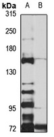 Neurexin 1 beta Rabbit Polyclonal Antibody