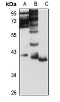 NSUN3 Antibody